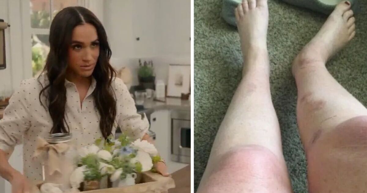 Meghan Markle threatened with £8m lawsuit after Netflix bath salts hack results in ‘burns&#039;