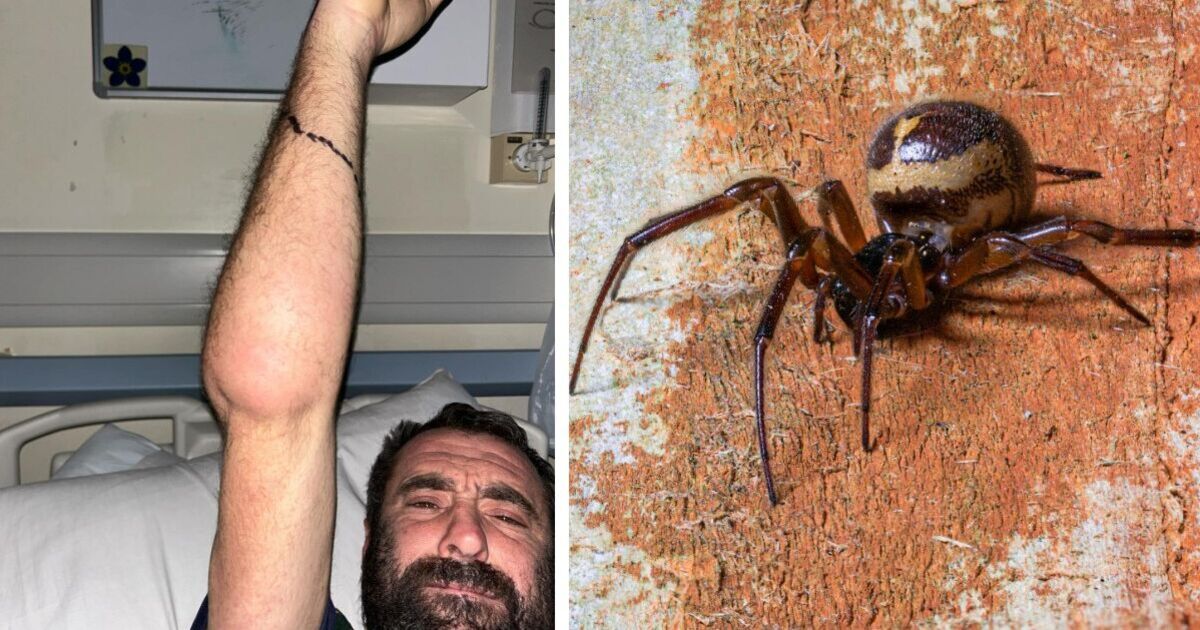 British dad&#039;s hand &#039;nearly exploded&#039; after bite from UK&#039;s deadliest spider while asleep