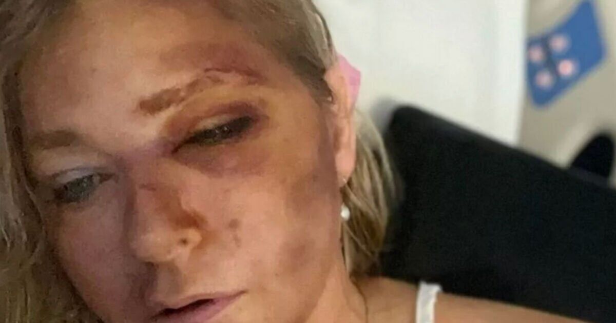 Virginia Giuffre health update as Prince Andrew sex accuser hits back at police